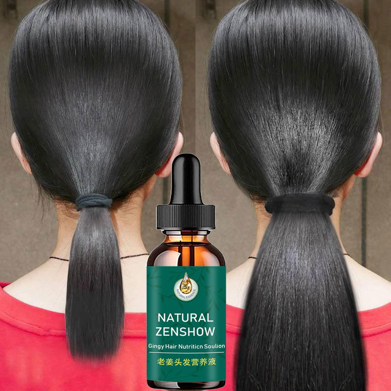 Hair Care Herbal Products - 생강 모발 성장 에센셜 오일 허브