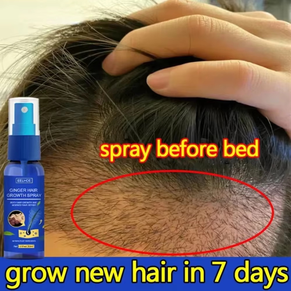 Hair Care Products - 빠른 생강 모발 성장 스프레이, 모발