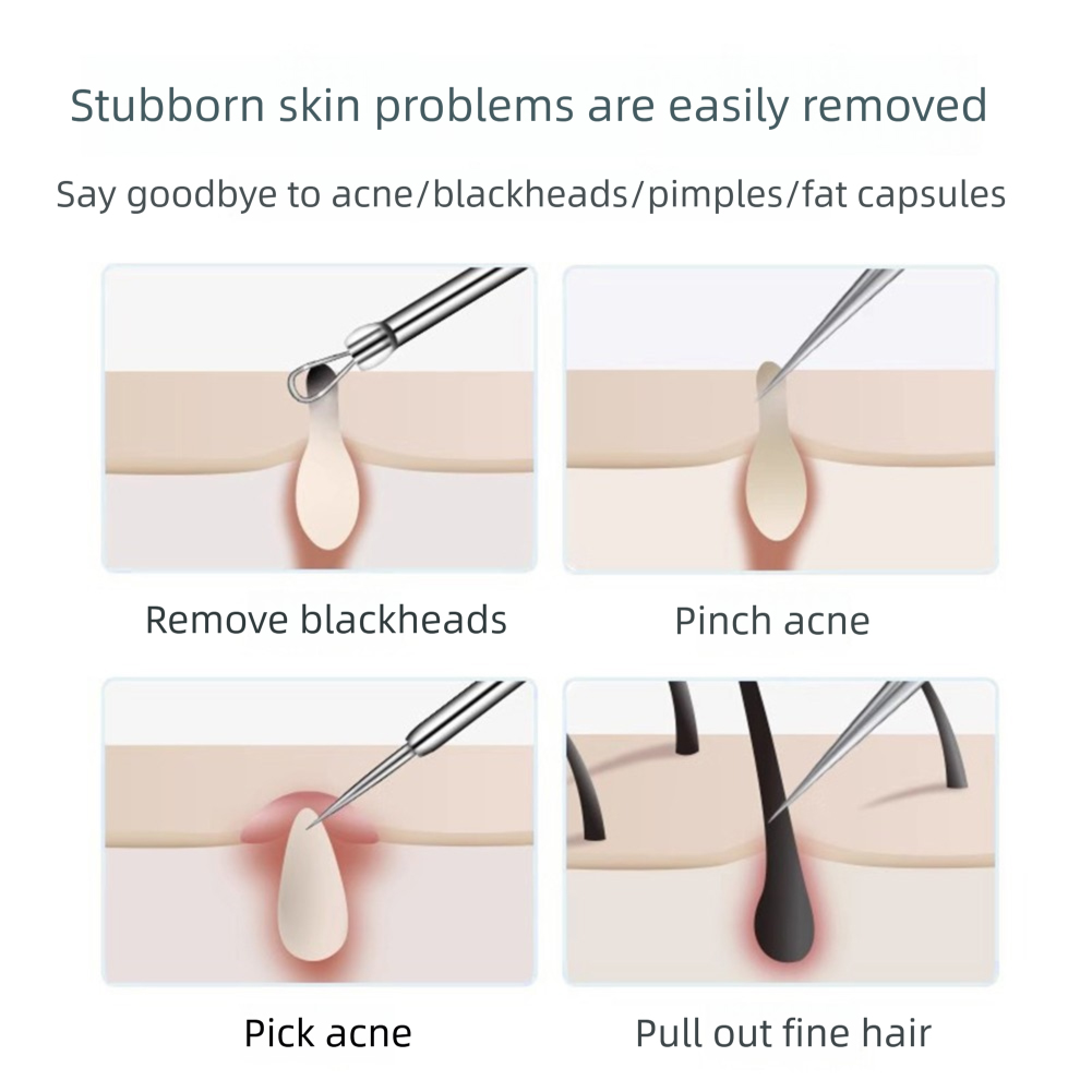 3-5pcs 자란 머리 족집게 여드름 여드름 제거 바늘 - Hair Care Clinic 리뷰 및 가격