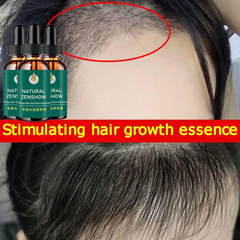 생강 모발 성장 에센셜 오일 허브 헤어 케어, 탈모 방 - Hair Care Herbal Products 리뷰 및 가격