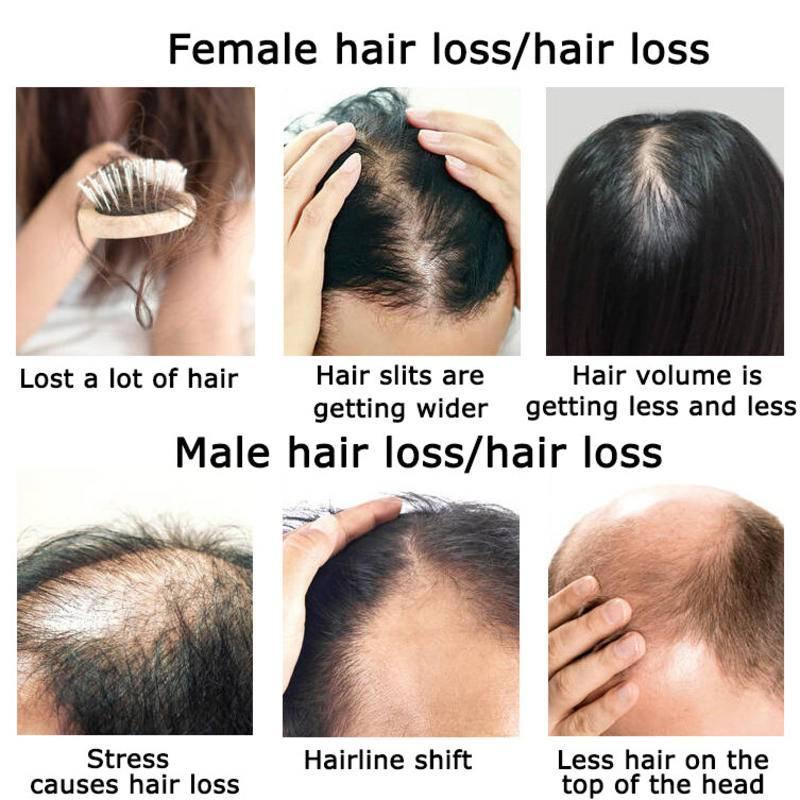 생강 모발 성장 에센셜 오일 허브 헤어 케어, 탈모 방 - Hair Care Herbal Products 리뷰 및 가격