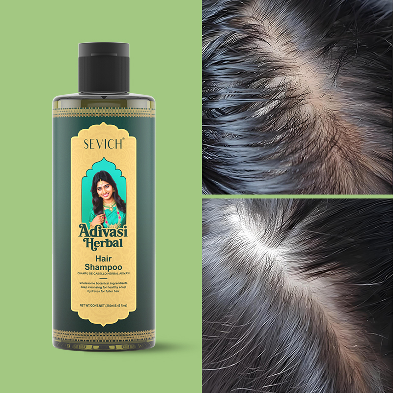 SEVICH 허벌 모발 성장 오일 세트 Ayurvedi - Hair Care Herbal Products 리뷰 및 가격