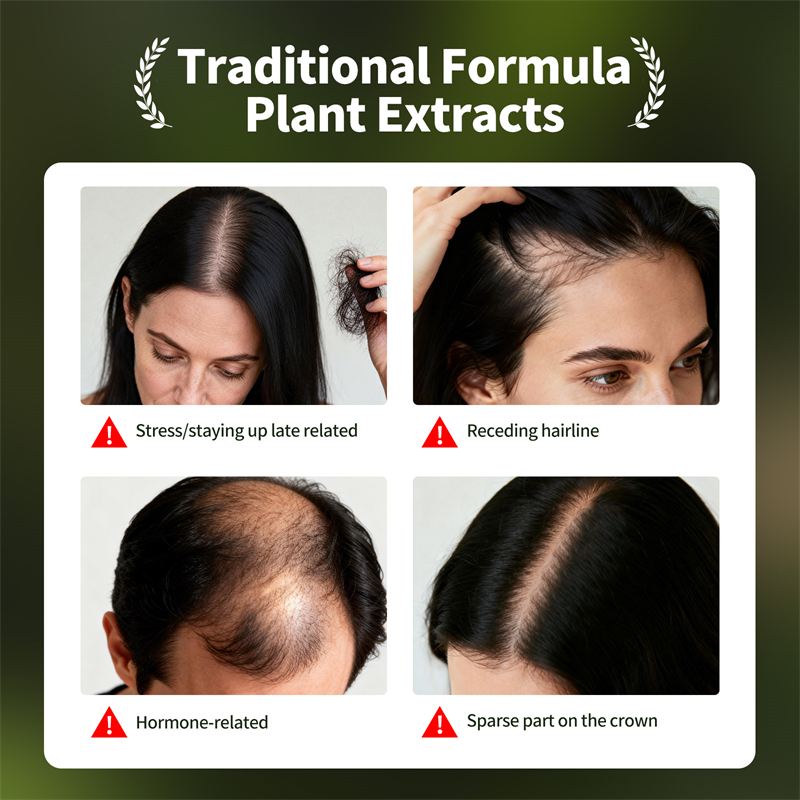 자연 모발 성장 세트 우스만 허브 샴푸 비누 허브 모발 - Hair Care Herbal Products 리뷰 및 가격