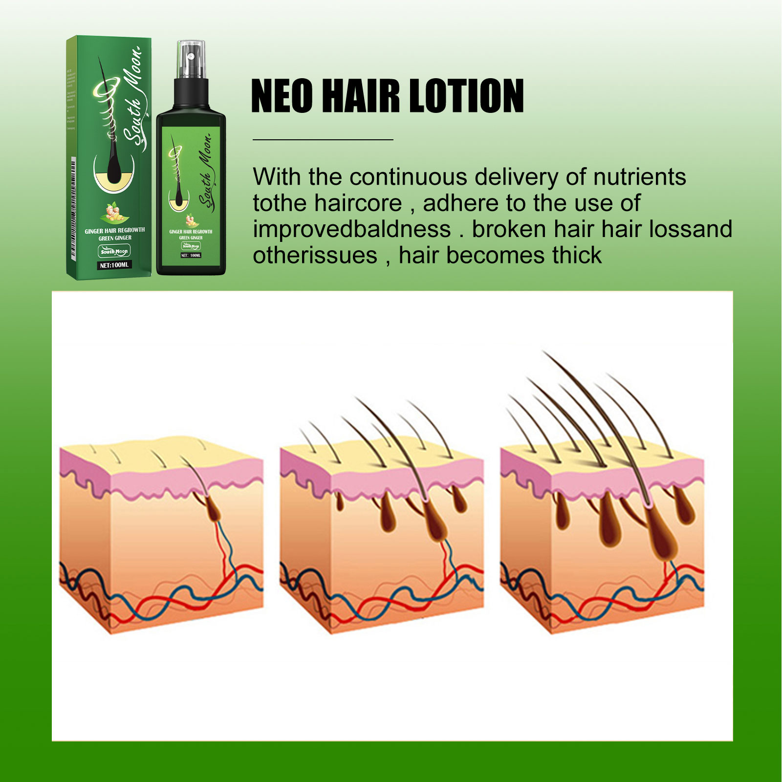 생강 헤어 케어 스프레이 모발 성장 촉진 허브 영양 공 - Hair Care Herbal Products 리뷰 및 가격