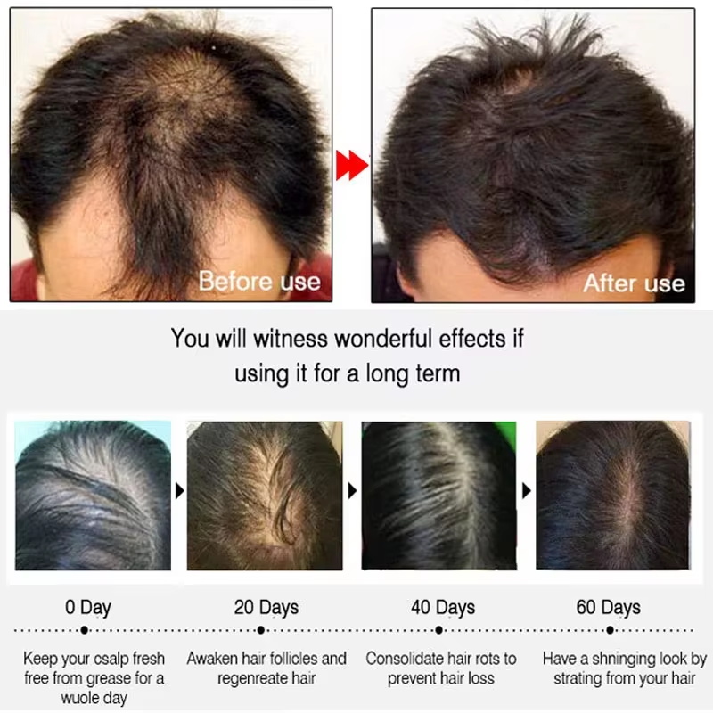 빠른 생강 모발 성장 스프레이, 모발 뿌리 강화, 탈모 - Hair Care Products 리뷰 및 가격
